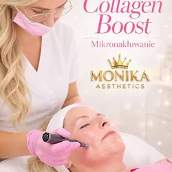 Microneedling session